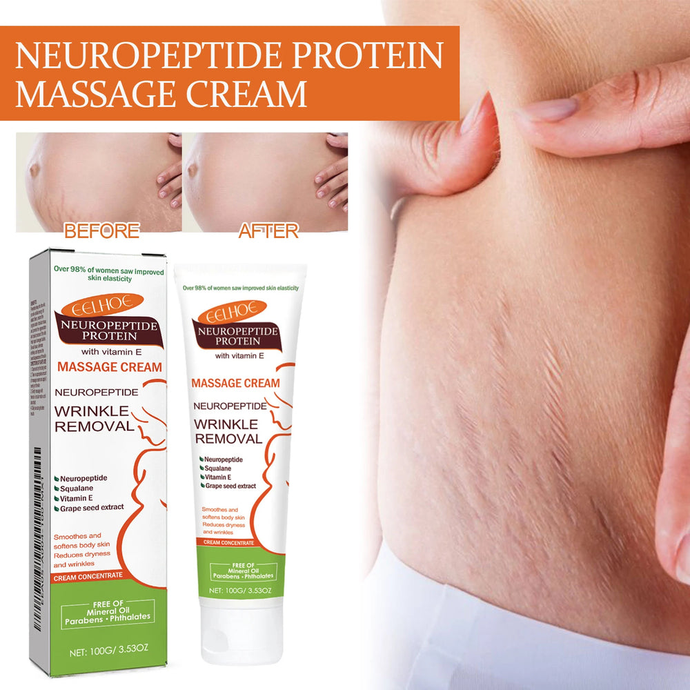 Stretch Marks Removal & Skin Firming Cream | Deep Repair Body Moisturiser | Braviixx