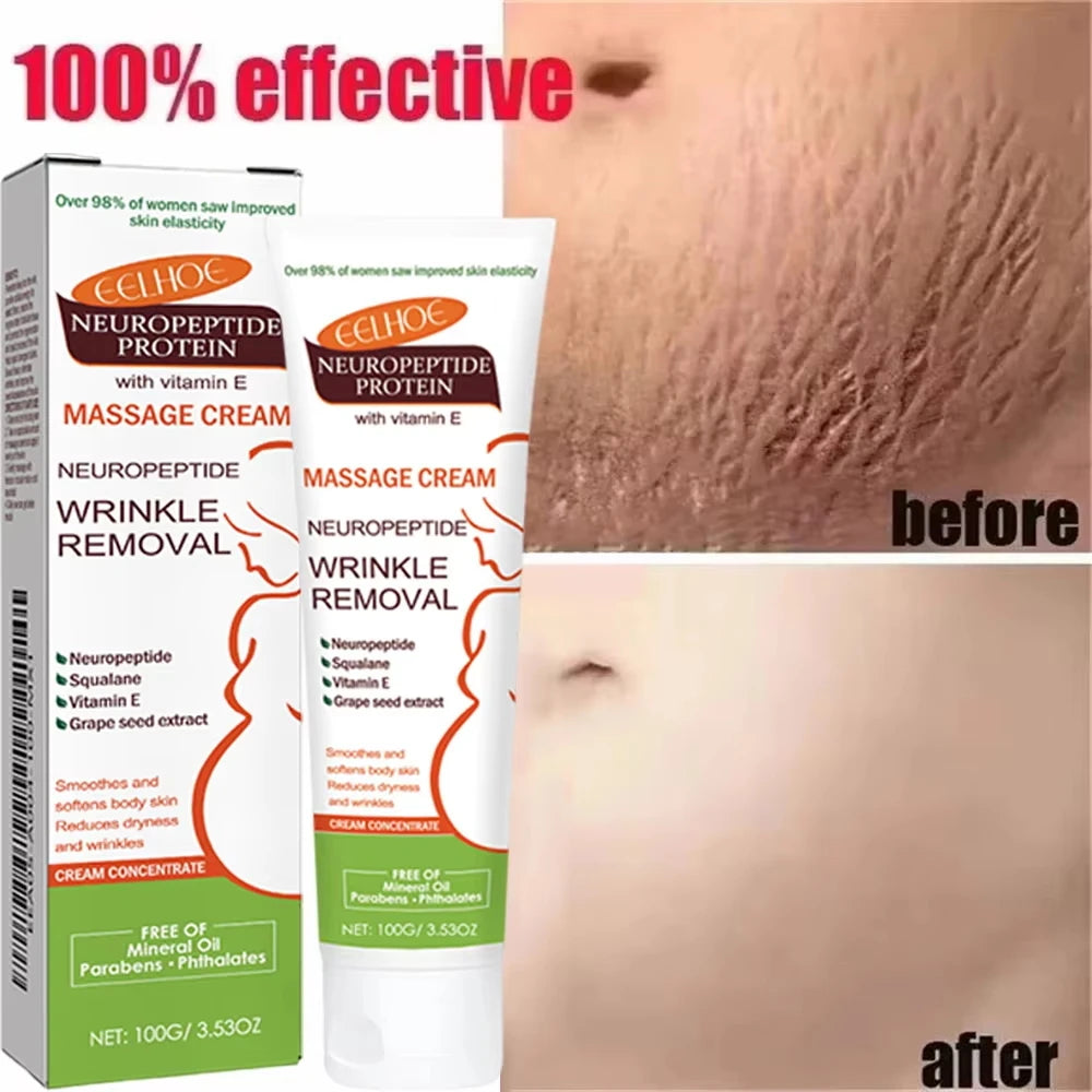 Stretch Marks Removal & Skin Firming Cream | Deep Repair Body Moisturiser | Braviixx