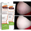 Stretch Marks Removal & Skin Firming Cream | Deep Repair Body Moisturiser | Braviixx