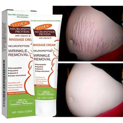 Stretch Marks Removal & Skin Firming Cream | Deep Repair Body Moisturiser | Braviixx