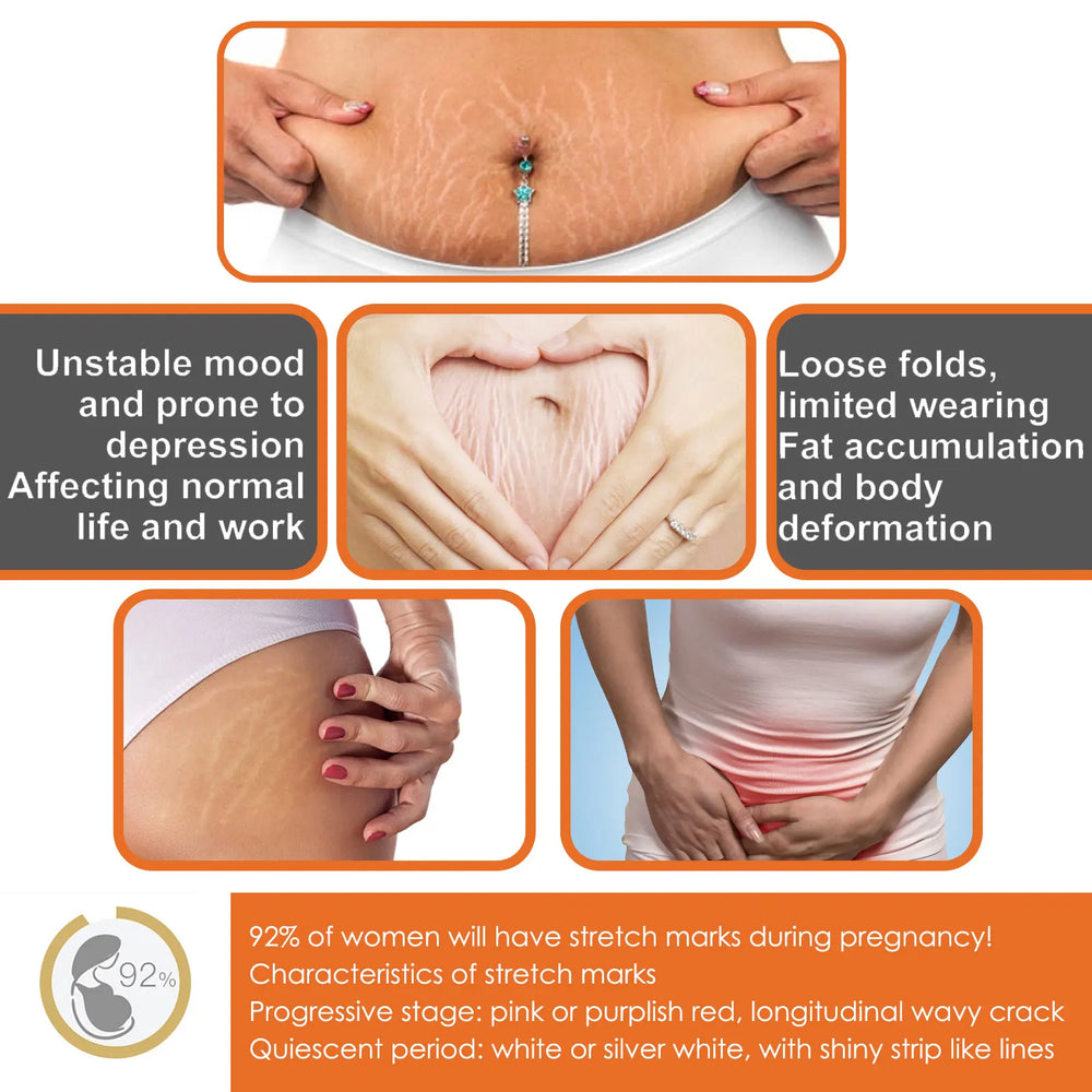 Stretch Marks Removal & Skin Firming Cream | Deep Repair Body Moisturiser | Braviixx