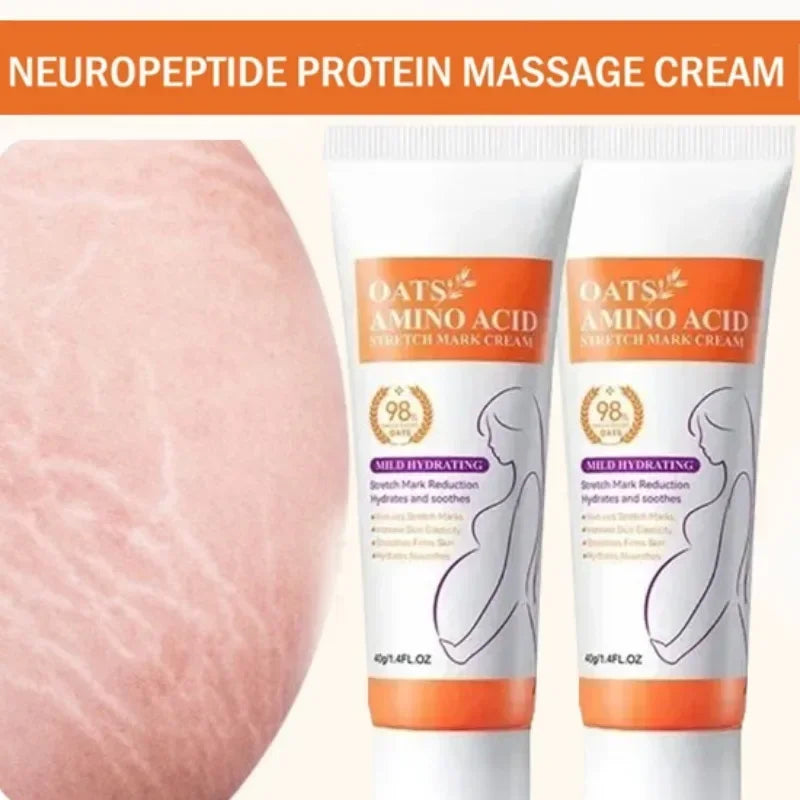 Stretch Mark Repair Cream | Helps Fade Body & Belly Marks | Braviixx