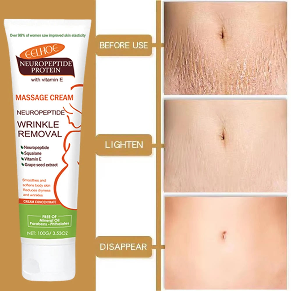 Stretch Marks Removal & Skin Firming Cream | Deep Repair Body Moisturiser | Braviixx