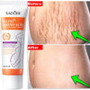 Stretch Mark Repair Cream | Helps Fade Body & Belly Marks | Braviixx
